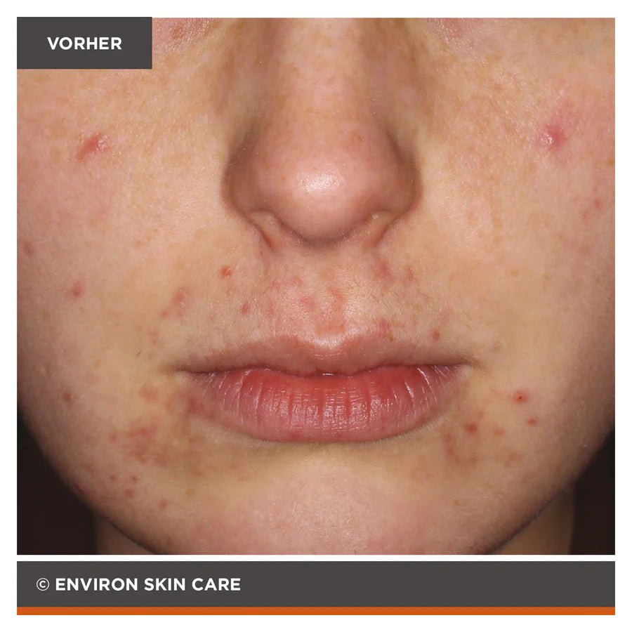 ENVIRON - Focus Care Clarity+ Botanical Infused Sebu-Tone Clarifier