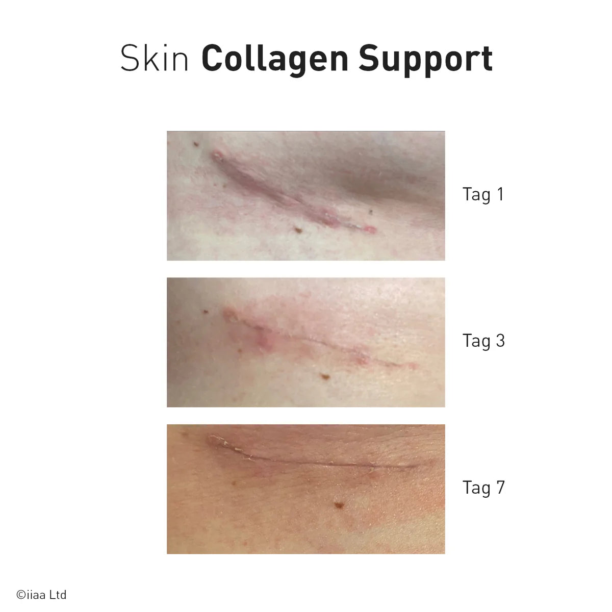 Advanced Nutrition Programme - Skin Collagen Support