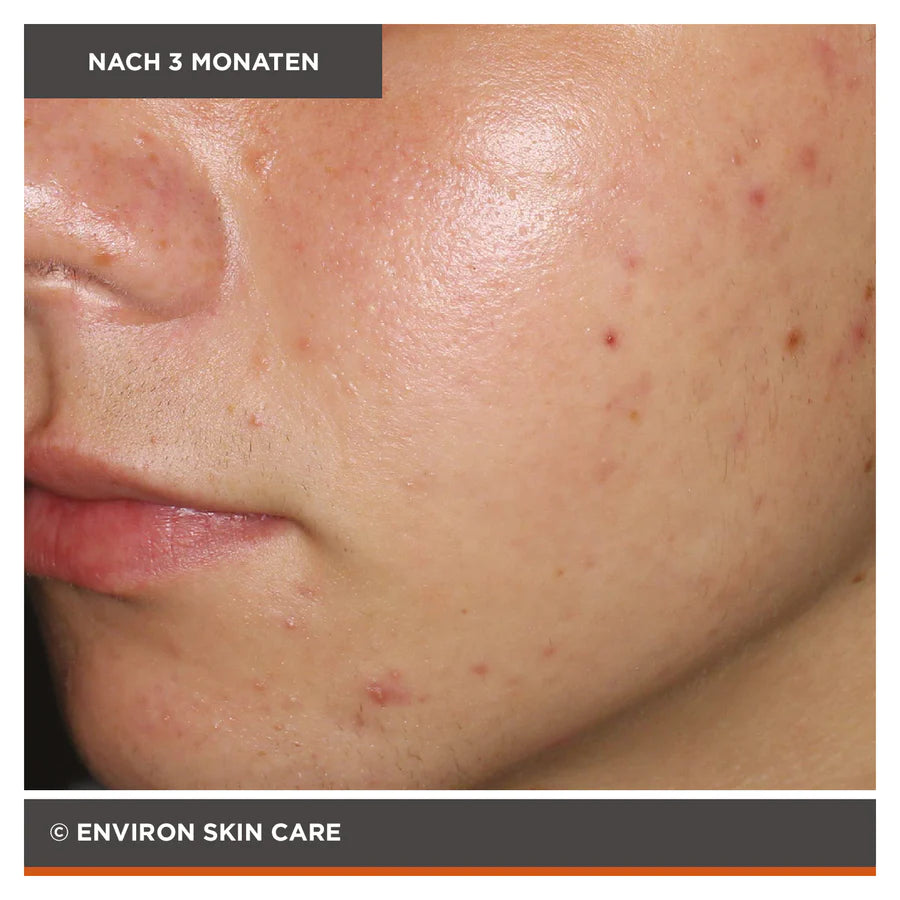ENVIRON - Focus Care Clarity+ Botanical Infused Sebu-Wash Gel Cleanser