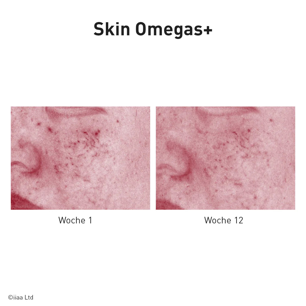 Advanced Nutrition Programme - Skin Omegas plus - Reisegröße