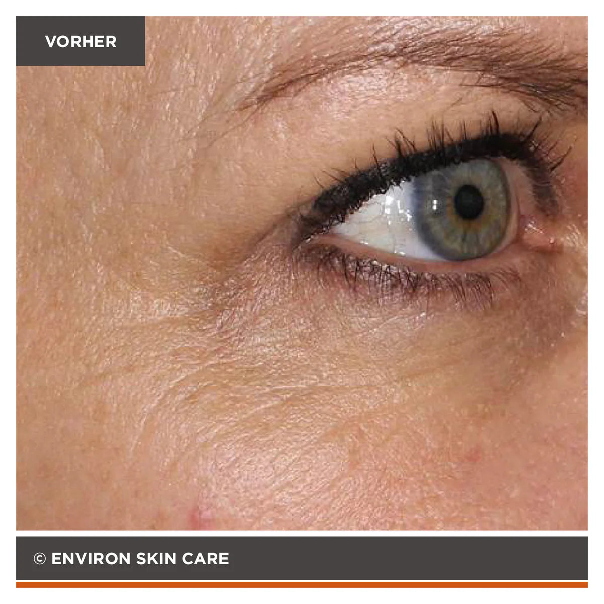 ENVIRON - Focus Care Youth+ Tri BioBotanical Revival Masque