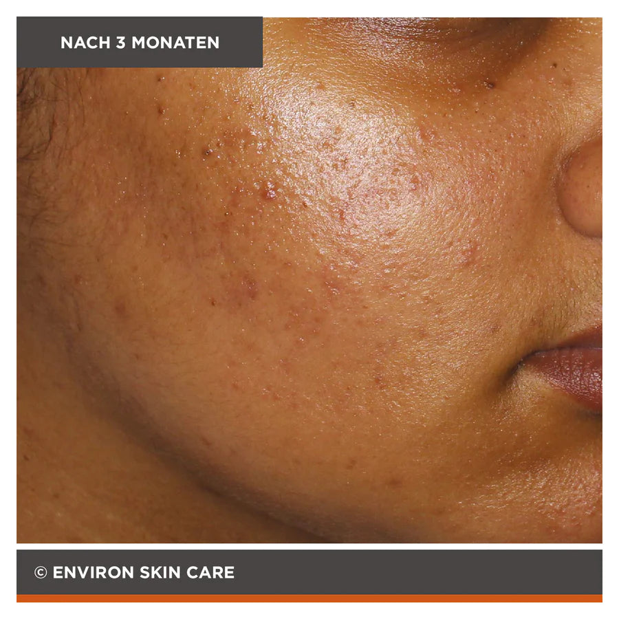ENVIRON - Focus Care Clarity+ Botanical Infused Sebu-Spot Blemish Gel