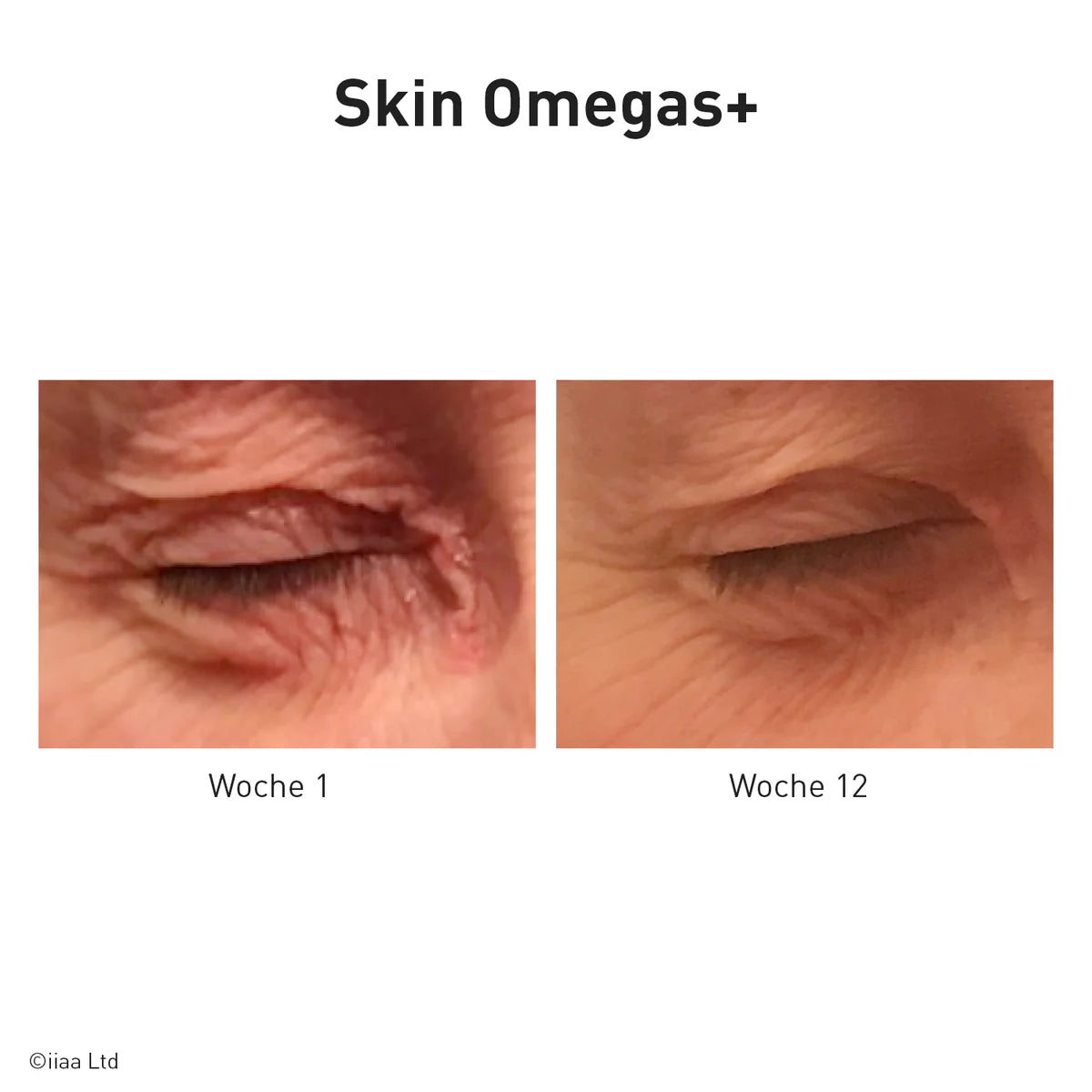 Advanced Nutrition Programme - Skin Omegas plus - Reisegröße