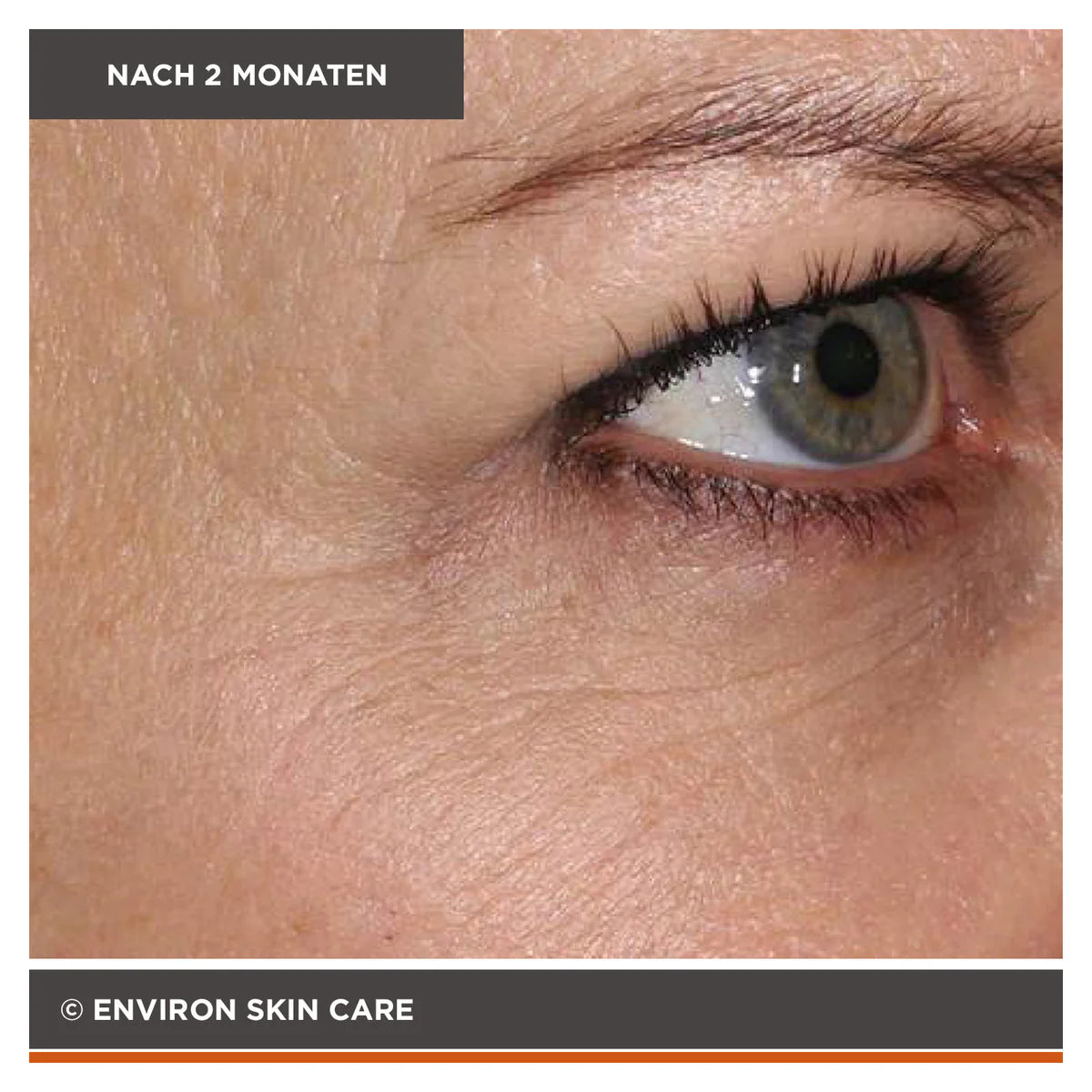 ENVIRON - Focus Care Youth+ Tri BioBotanical Revival Masque