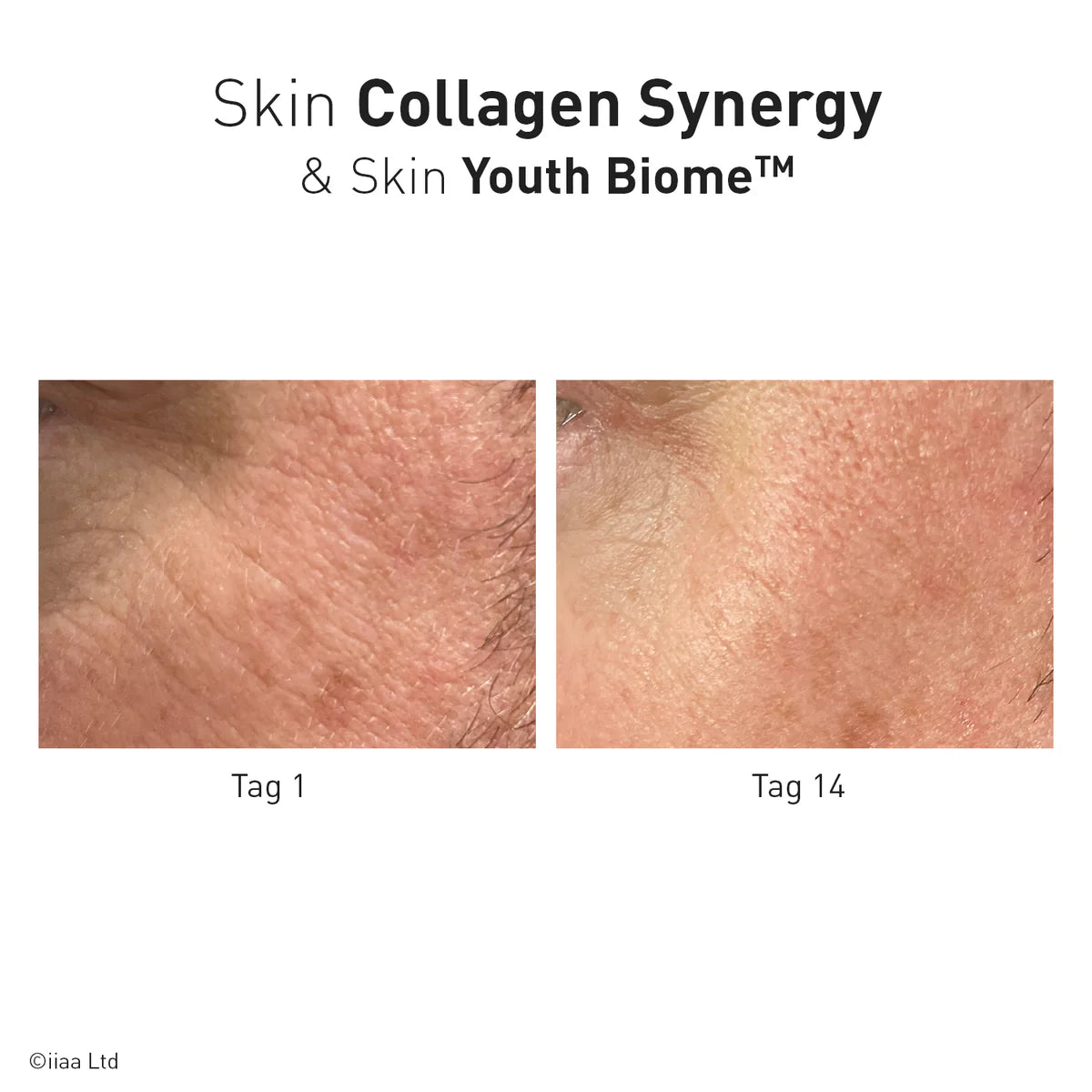 Advanced Nutrition Programme - Skin Collagen Synergy
