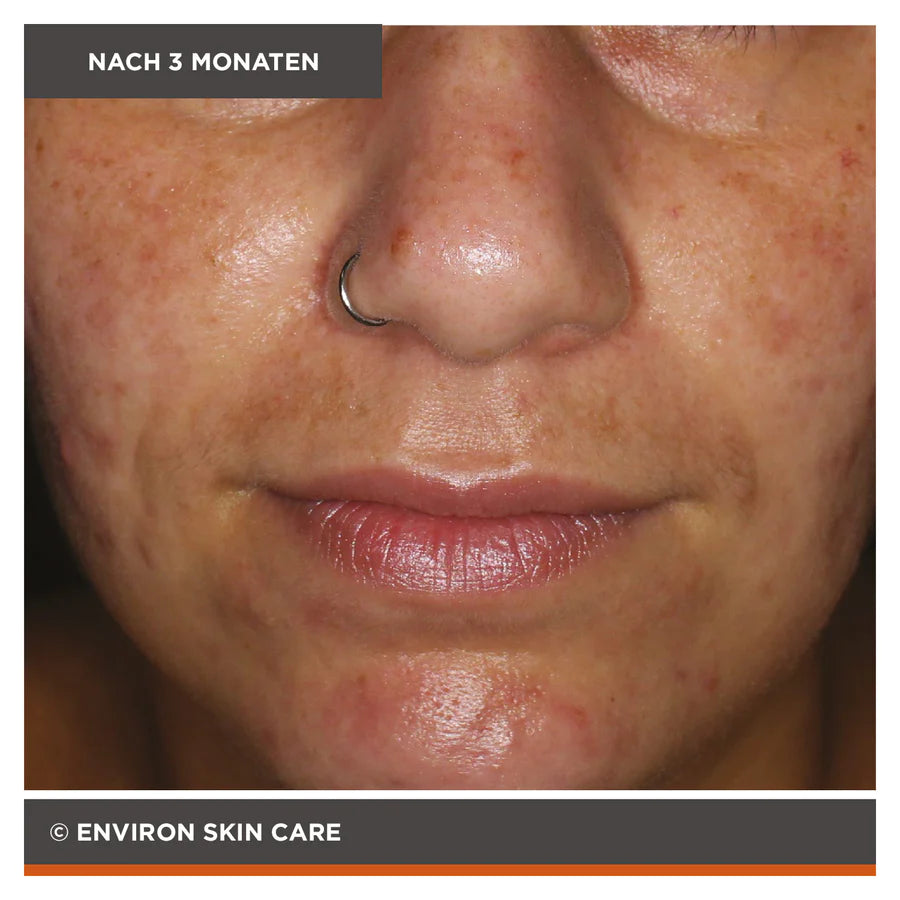 ENVIRON - Focus Care Clarity+ Hydroxy Acid Sebu-Lac Lotion