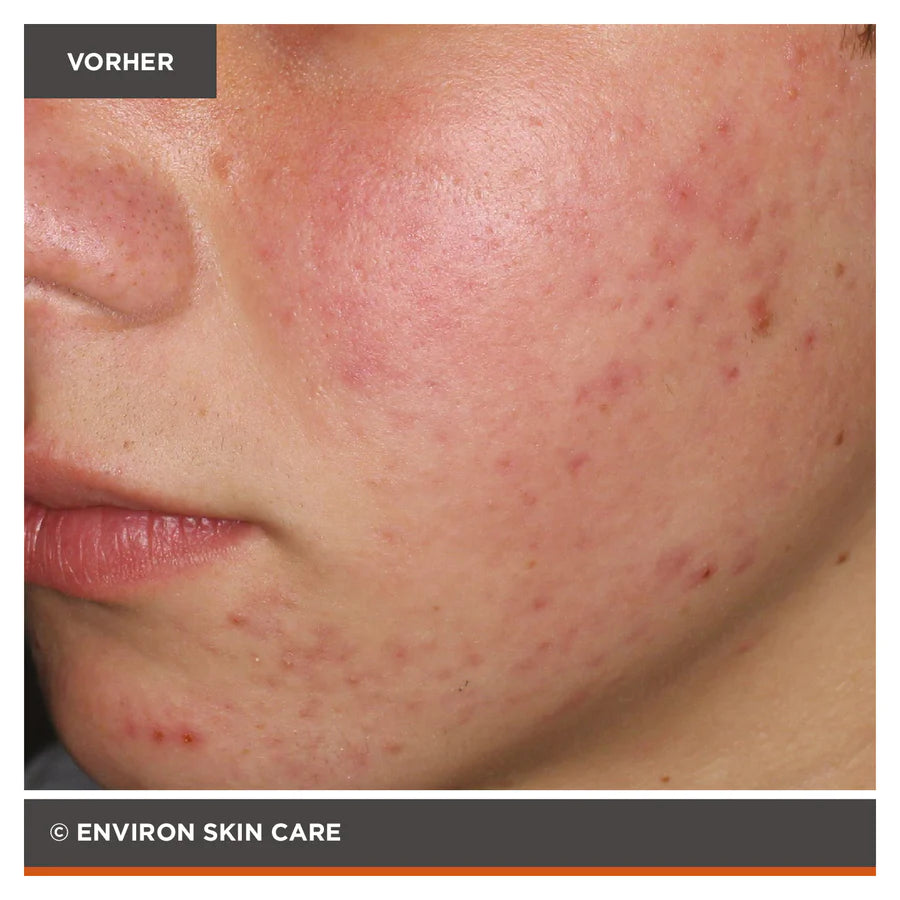 ENVIRON - Focus Care Clarity+ Botanical Infused Sebu-Wash Gel Cleanser