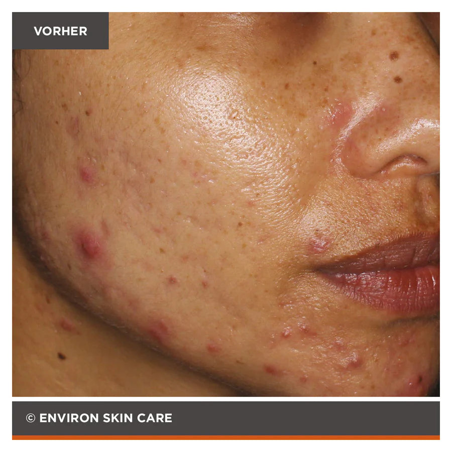 ENVIRON - Focus Care Clarity+ Vita-Botanical Sebu-ACE Oil
