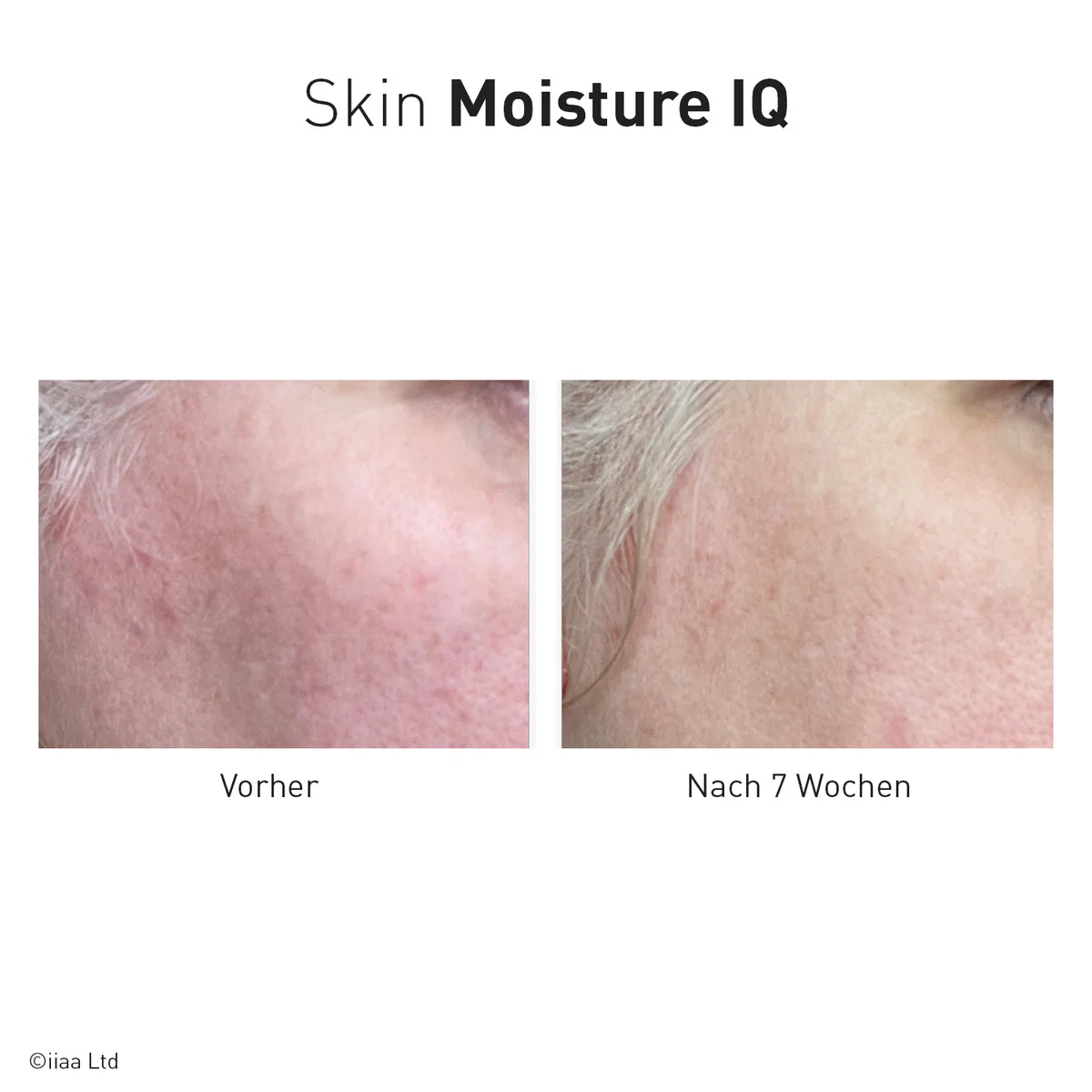 Advanced Nutrition Programme - Skin Moisture IQ
