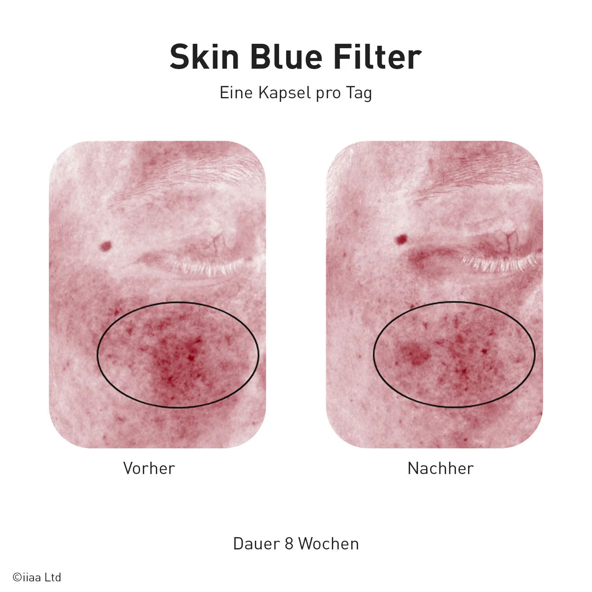 Advanced Nutrition Programme - Skin Blue Filter