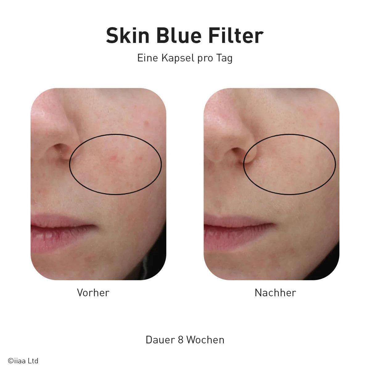 Advanced Nutrition Programme - Skin Blue Filter