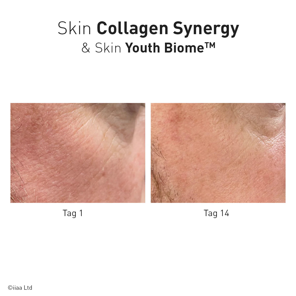 Advanced Nutrition Programme - Skin Collagen Synergy