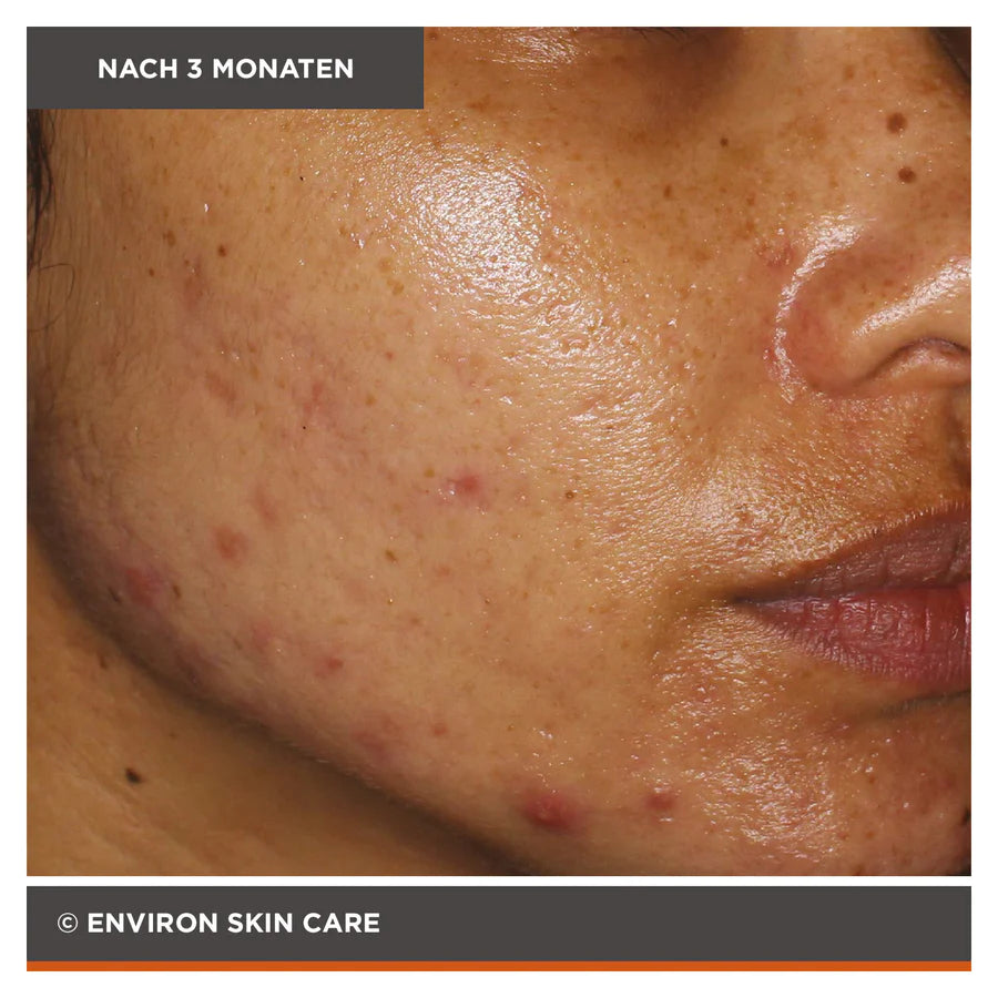 ENVIRON - Focus Care Clarity+ Vita-Botanical Sebu-ACE Oil