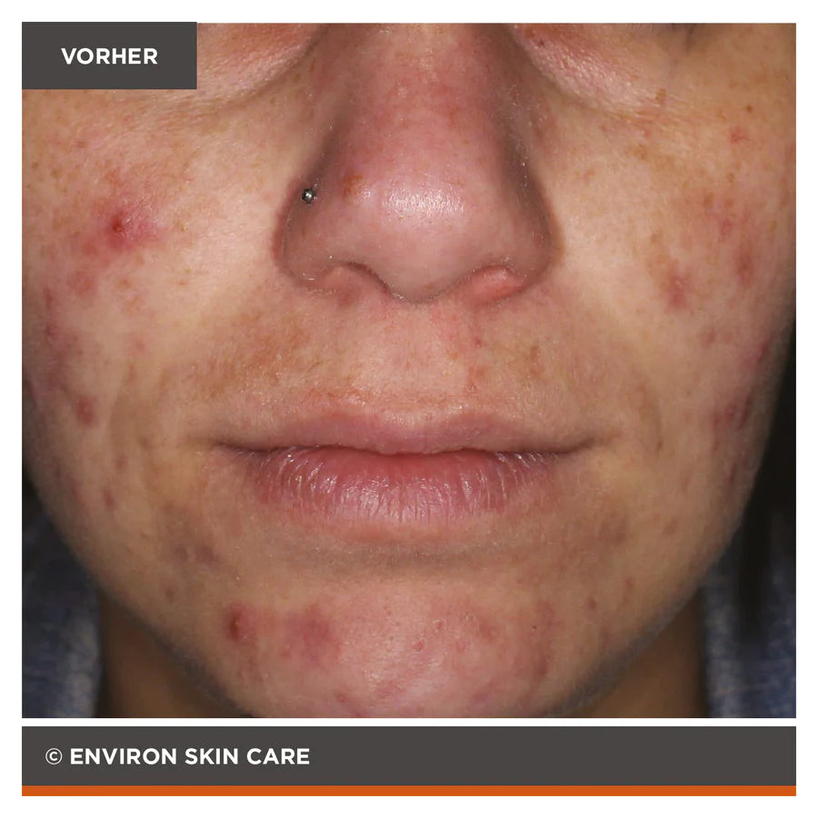 ENVIRON - Focus Care Clarity+ Hydroxy Acid Sebu-Lac Lotion