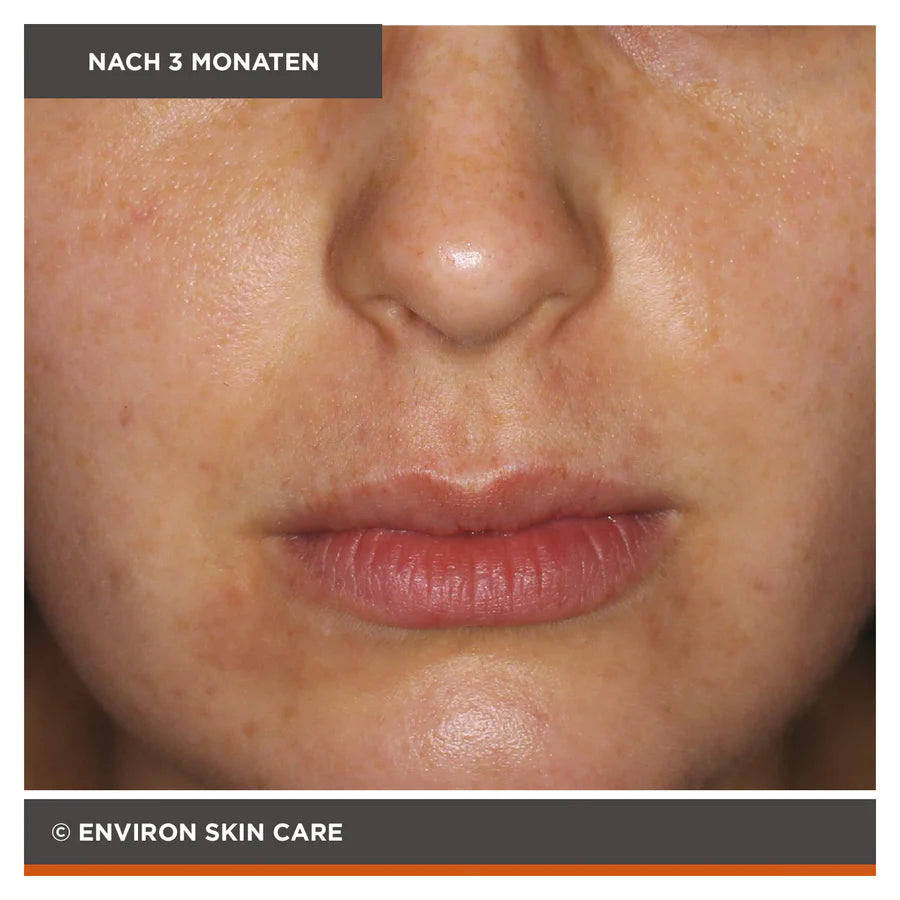 ENVIRON - Focus Care Clarity+ Botanical Infused Sebu-Tone Clarifier