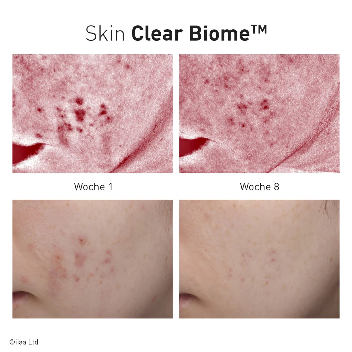 Advanced Nutrition Programme - Skin Clear Biome