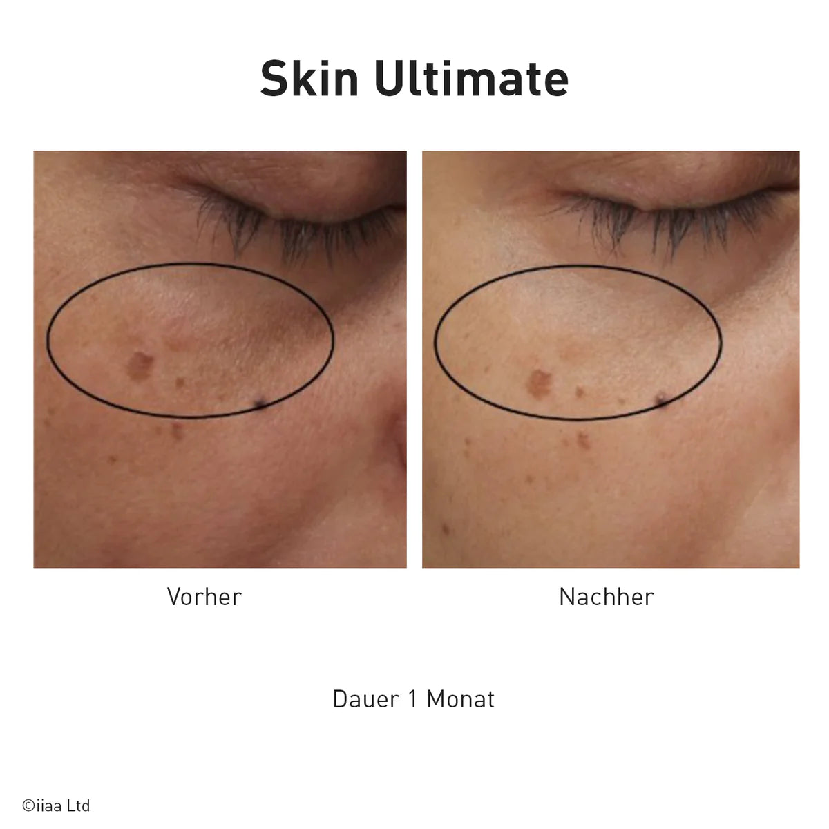 Advanced Nutrition Programme - Skin Ultimate