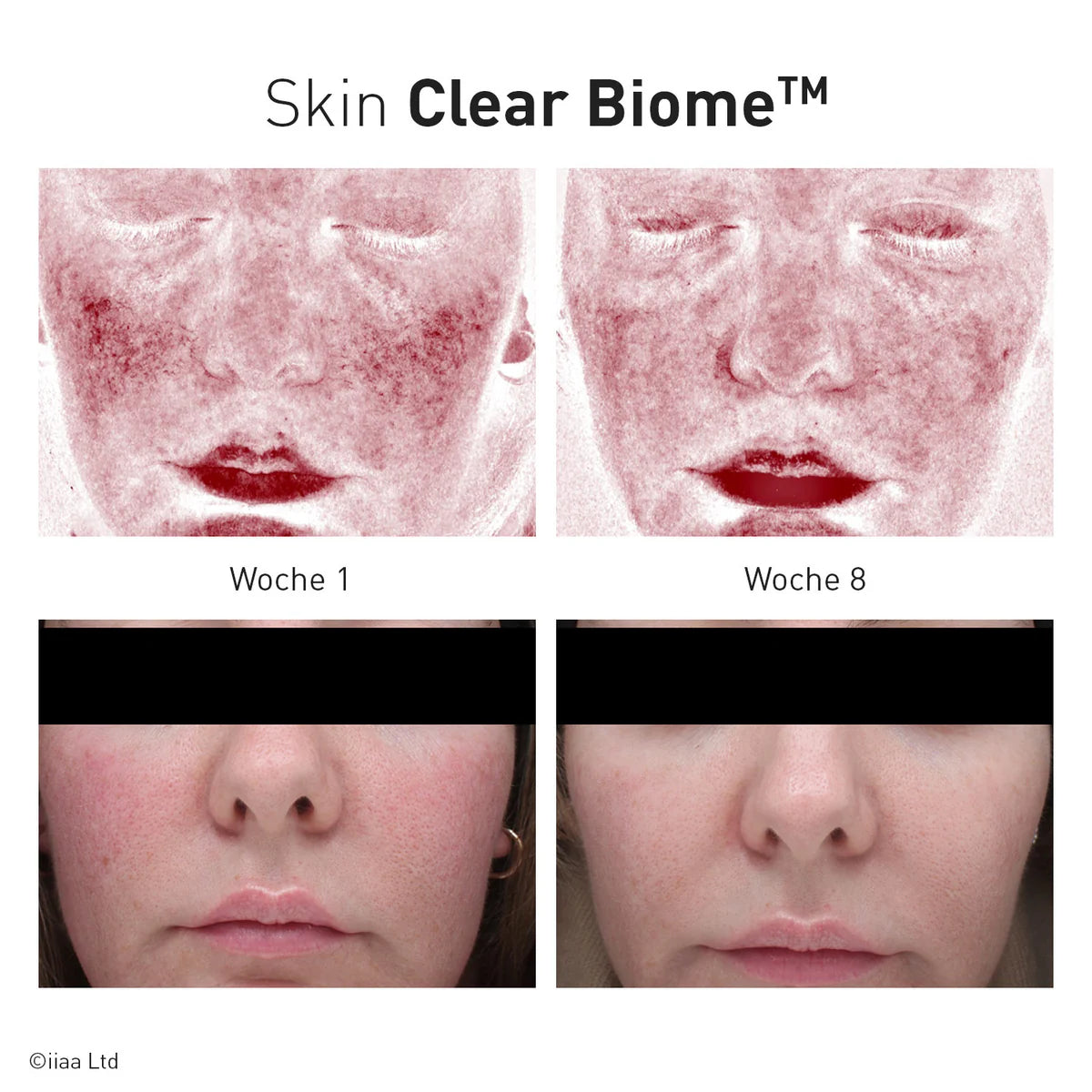 Advanced Nutrition Programme - Skin Clear Biome