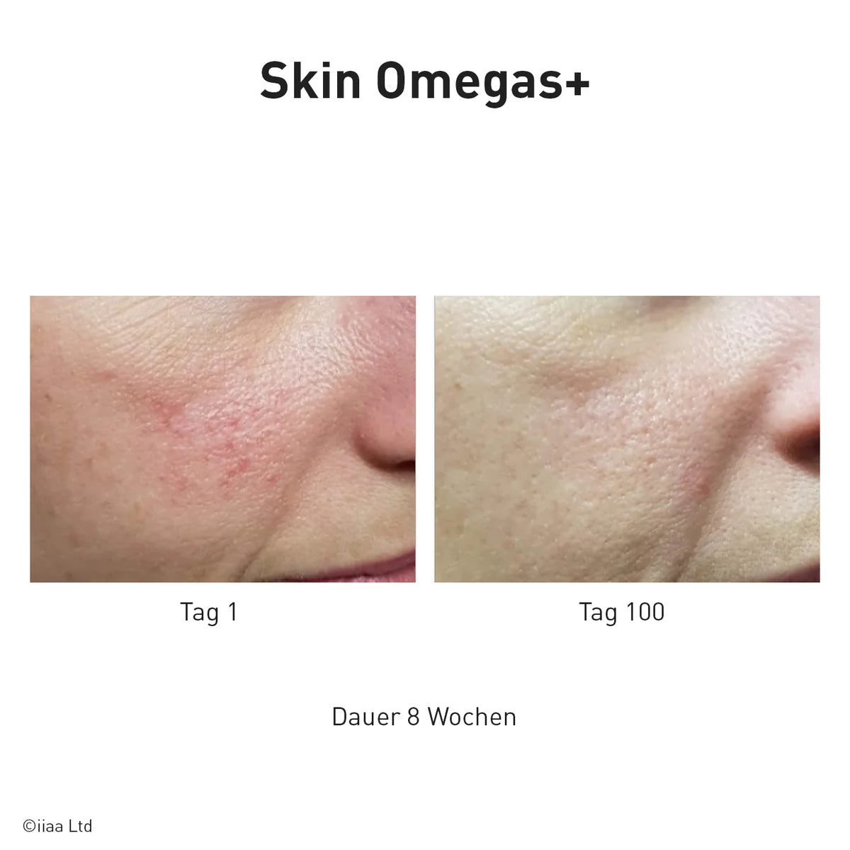 Advanced Nutrition Programme - Skin Omegas plus - Reisegröße