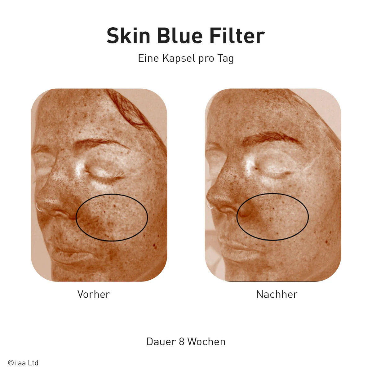 Advanced Nutrition Programme - Skin Blue Filter