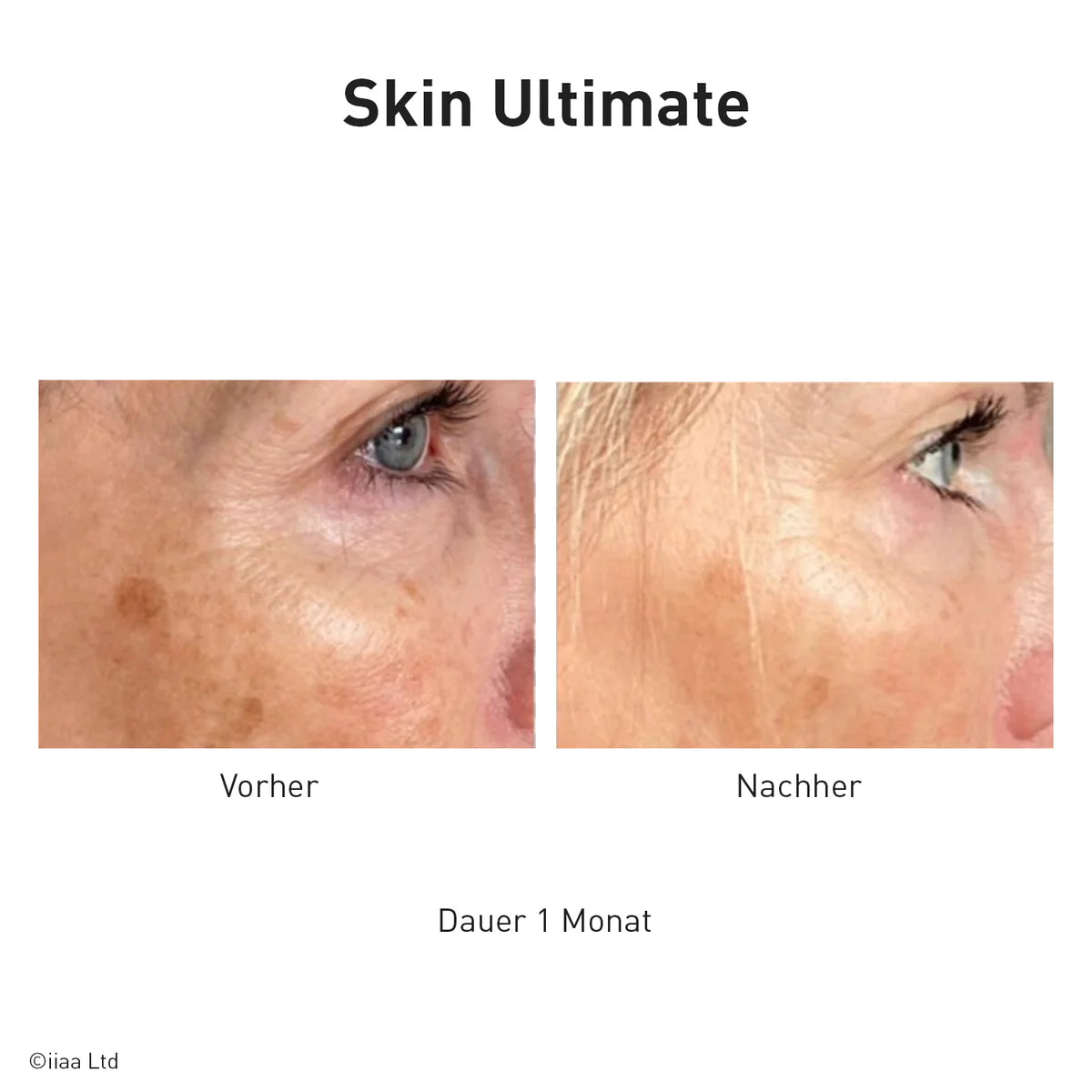 Advanced Nutrition Programme - Skin Ultimate