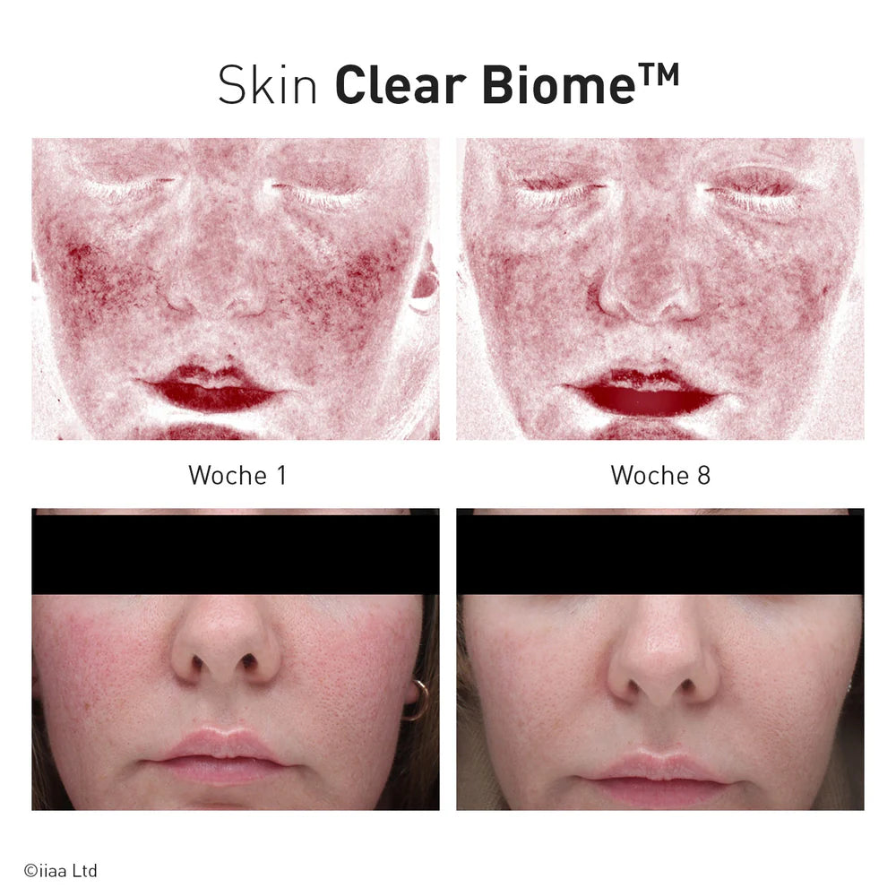 Advanced Nutrition Programme - Skin Clear Biome - Discovery Pack