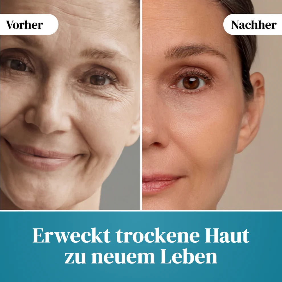 Atamé - Urea Hyaluron Creme Forte