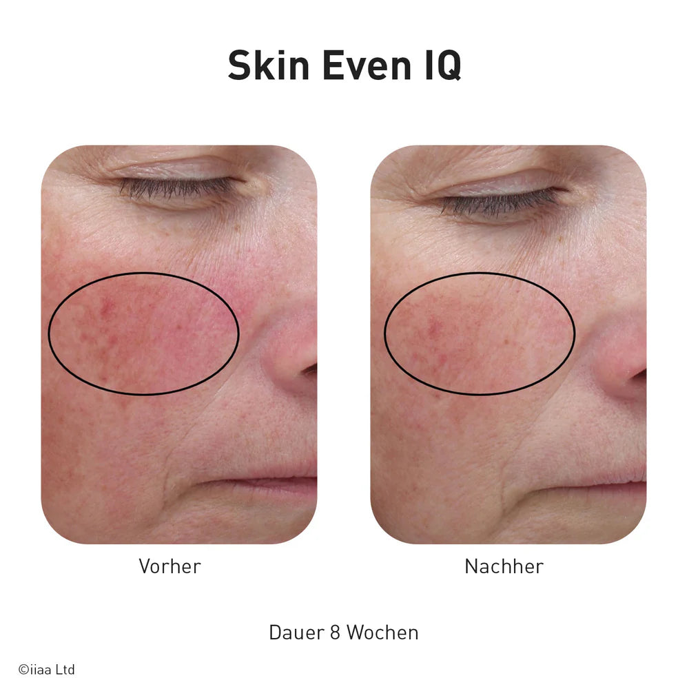 Advanced Nutrition Programme - Skin Even IQ
