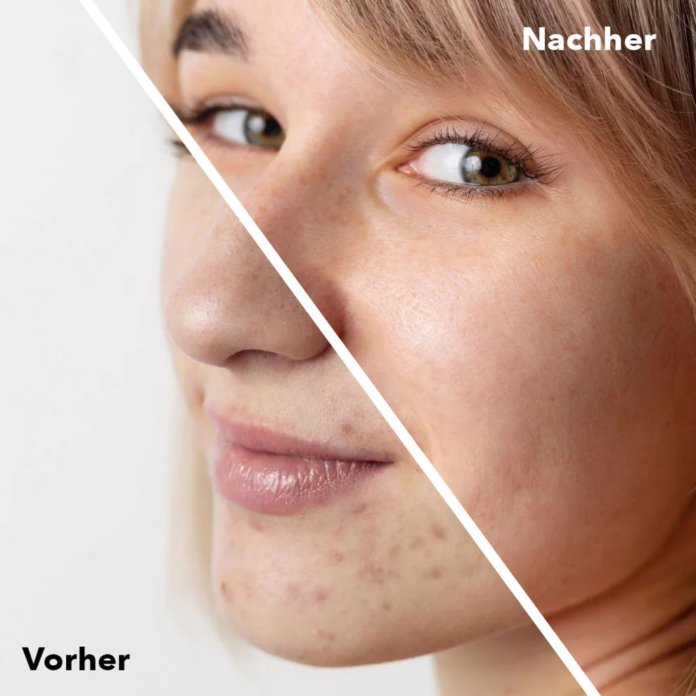 Atame - Hautpflege Tonic Sensitive